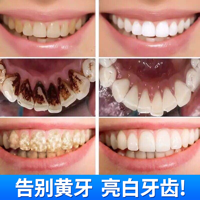 Clean teeth mousse fresh tone to tooth stains in addition to bad breath oral cleaning care foam mouthwash teeth whitening