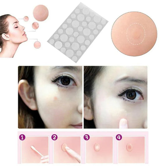 Acne Patch Skin Tags Beauty Set Remover Pimple Master Patch Treatment skin tag removal black head remover tool acne remover
